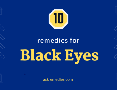 black eyes remedies