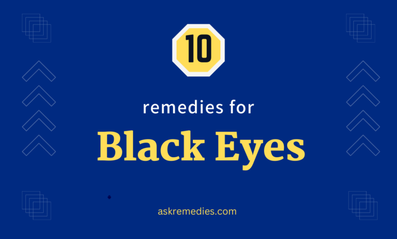 black eyes remedies