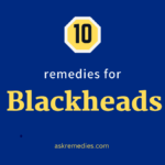 Remedies For Blackheads