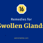 Home Remedies for Swollen Glands